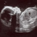 Scan photos of Anna